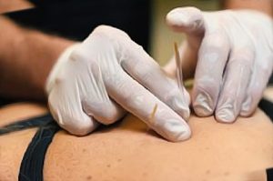 Melbourne dry needling courses